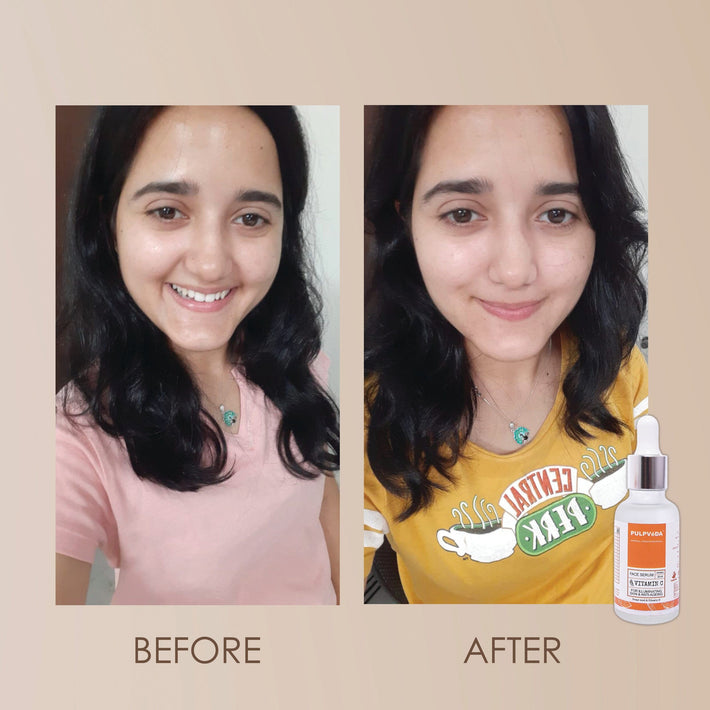 VITAMIN C BRIGHTENING FACE SERUM WITH GRAPESEED & VITAMINE 30ml COLL