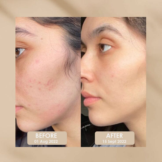 VITAMIN C BRIGHTENING FACE SERUM WITH GRAPESEED & VITAMINE 30ml COLL